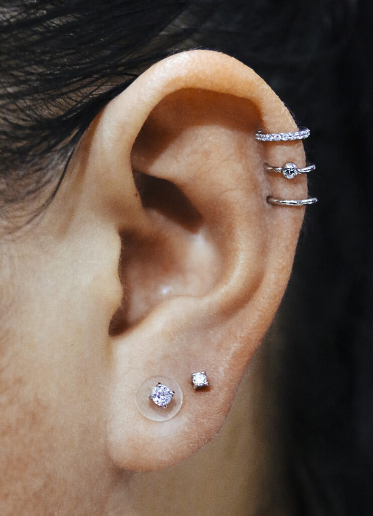 rook piercing keloid